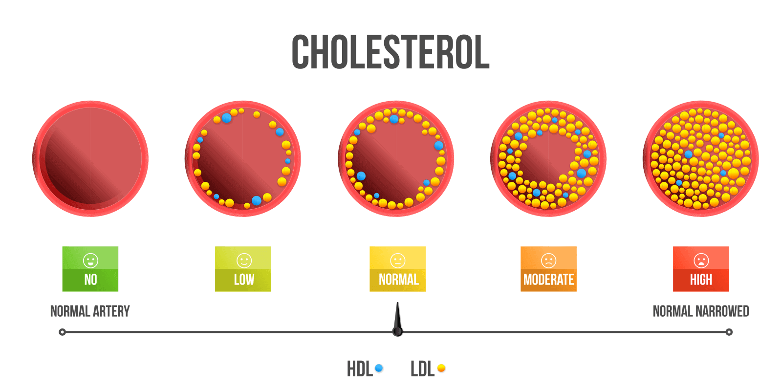 What Causes High Cholesterol? Understanding the Risk Factors ...